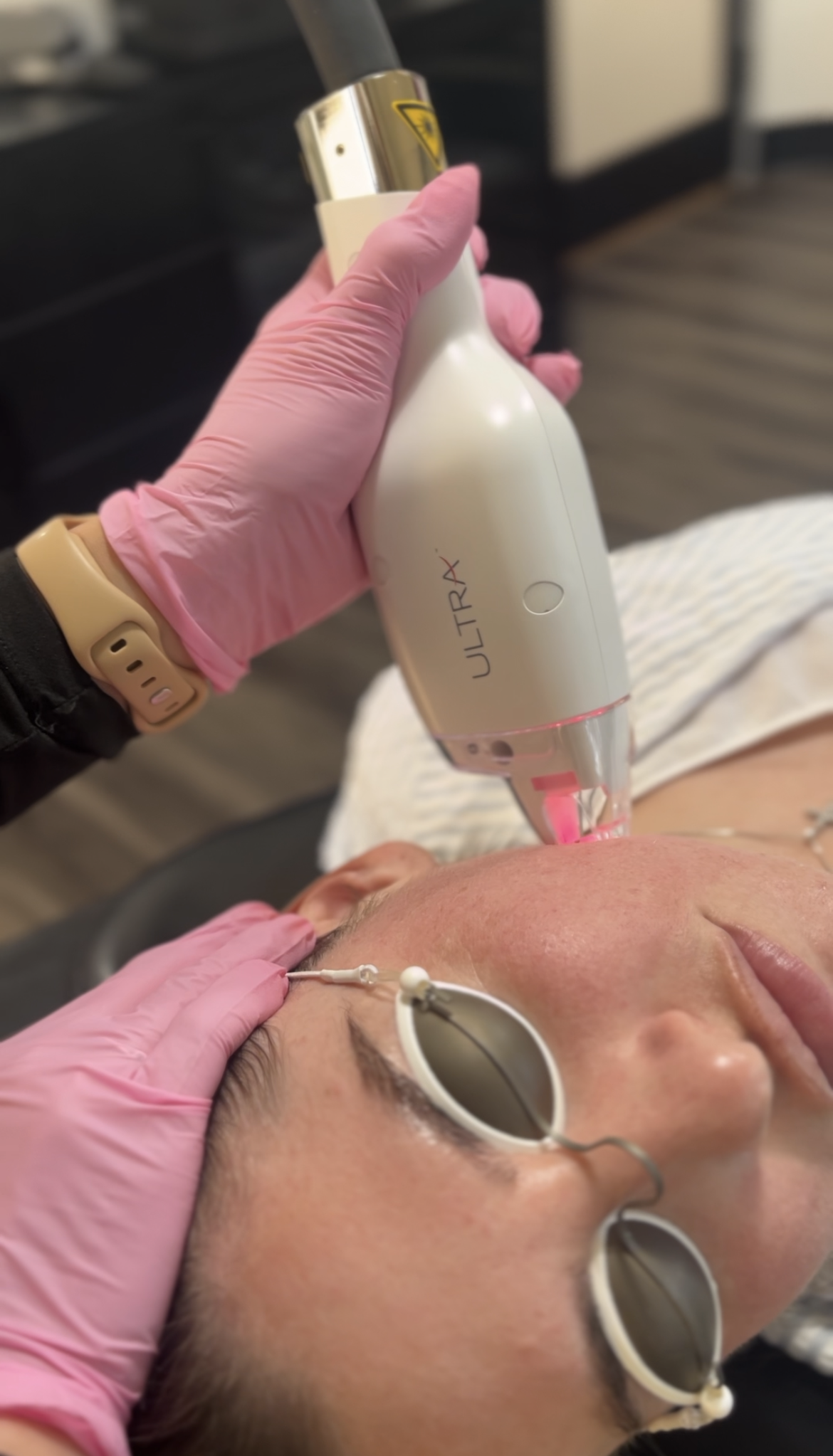 female model receiving handheld resurfacing laser treatment on jawline