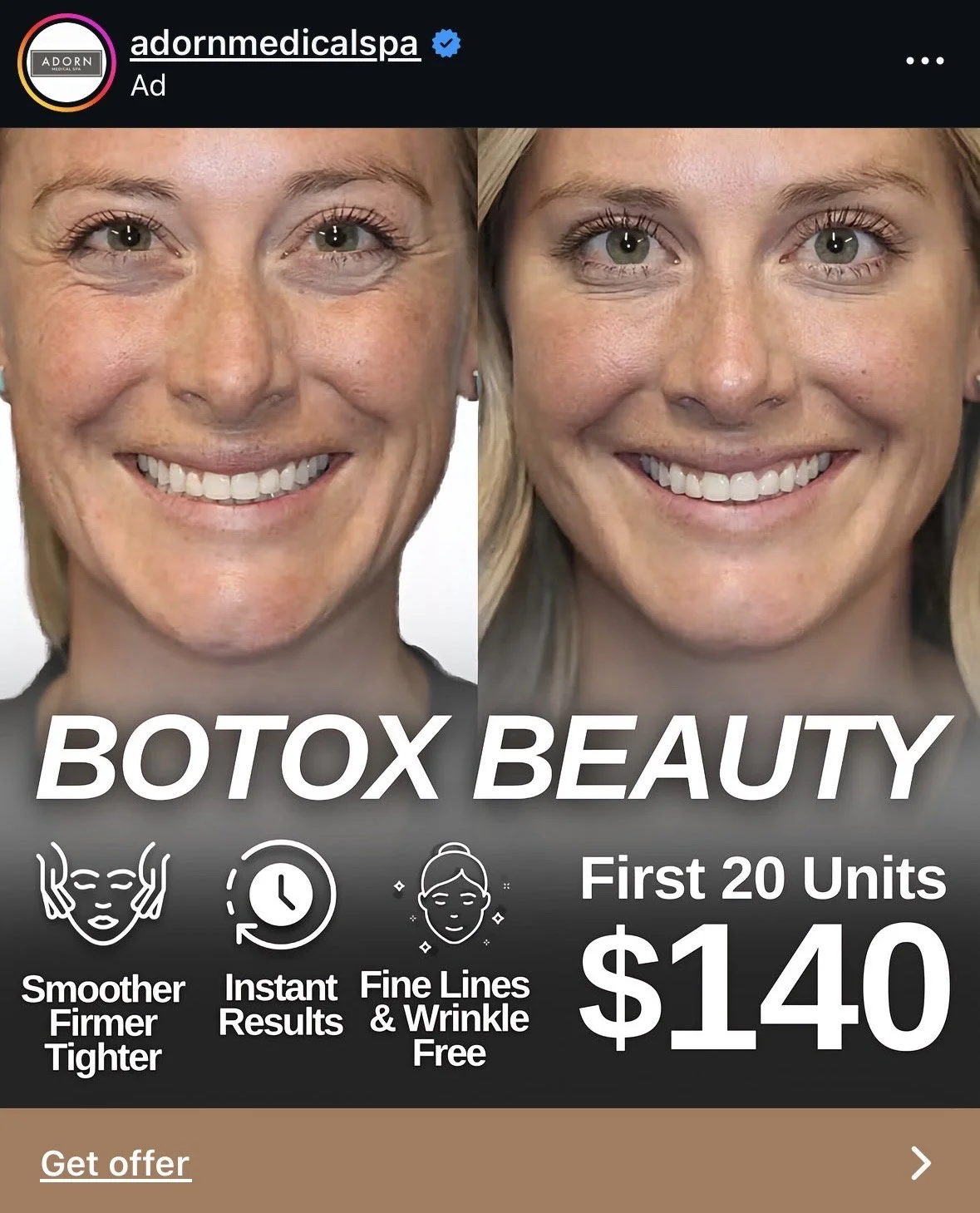 botox smile.jpg