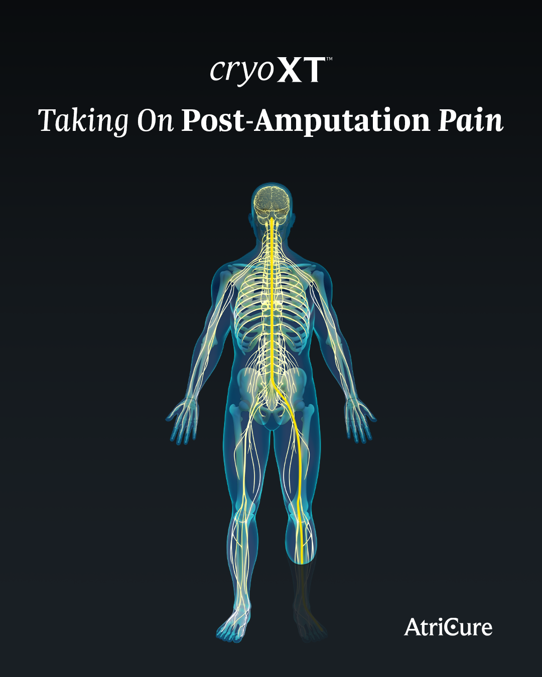 SOCM-1002-Amputation-MarchExtremityx3-FEB2026_4x5-1A_v1.png