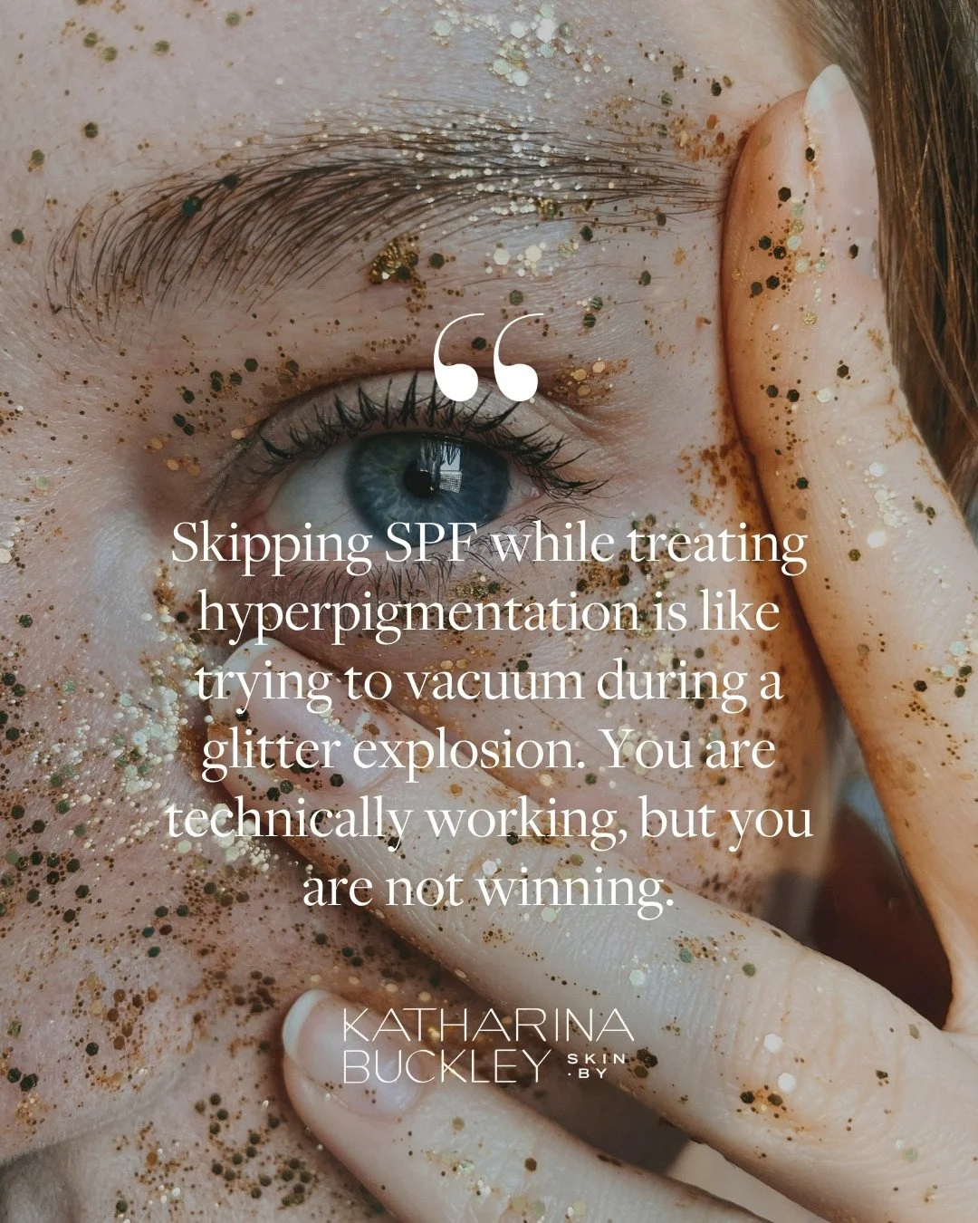 When your skin detects UV light, it panics. It signals your melanocytes (the cell factories) to pump out excess melanin as a defense mechanism. The result? Those stubborn dark spots, sun spots, and patches of uneven tone we call hyperpigmentation.⁠
⁠