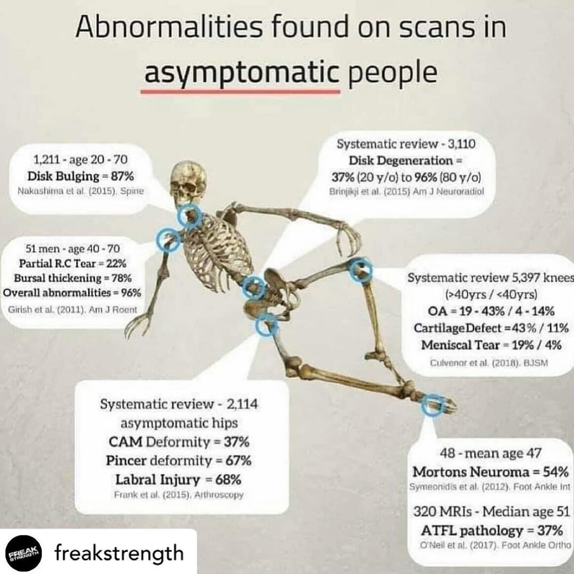 Physical Therapists know this better than any one else.

That&rsquo;s why we are recommended first before pharmaceuticals, injections, or surgeries.

We treat the patient not the scan.

Most of our patients don&rsquo;t need surgery, some do (5-10%), 