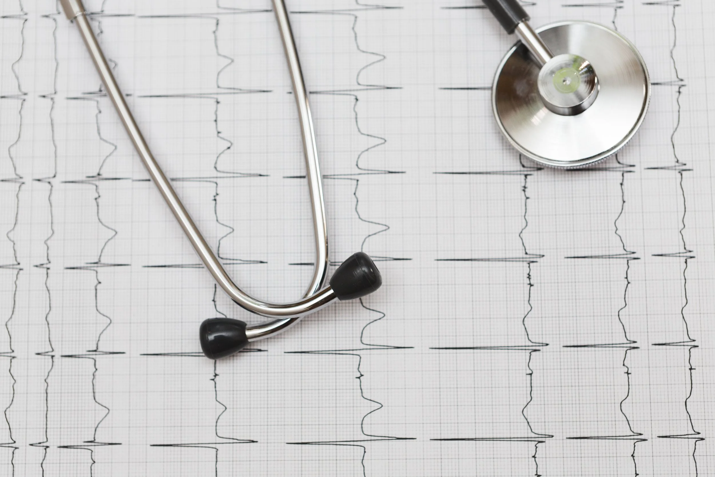 Stethoscope placed on an electrocardiogram (ECG) graph paper.