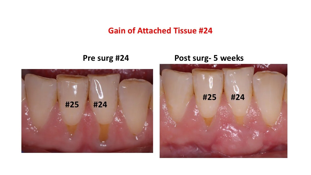 Comparison #24-25 Template.jpg