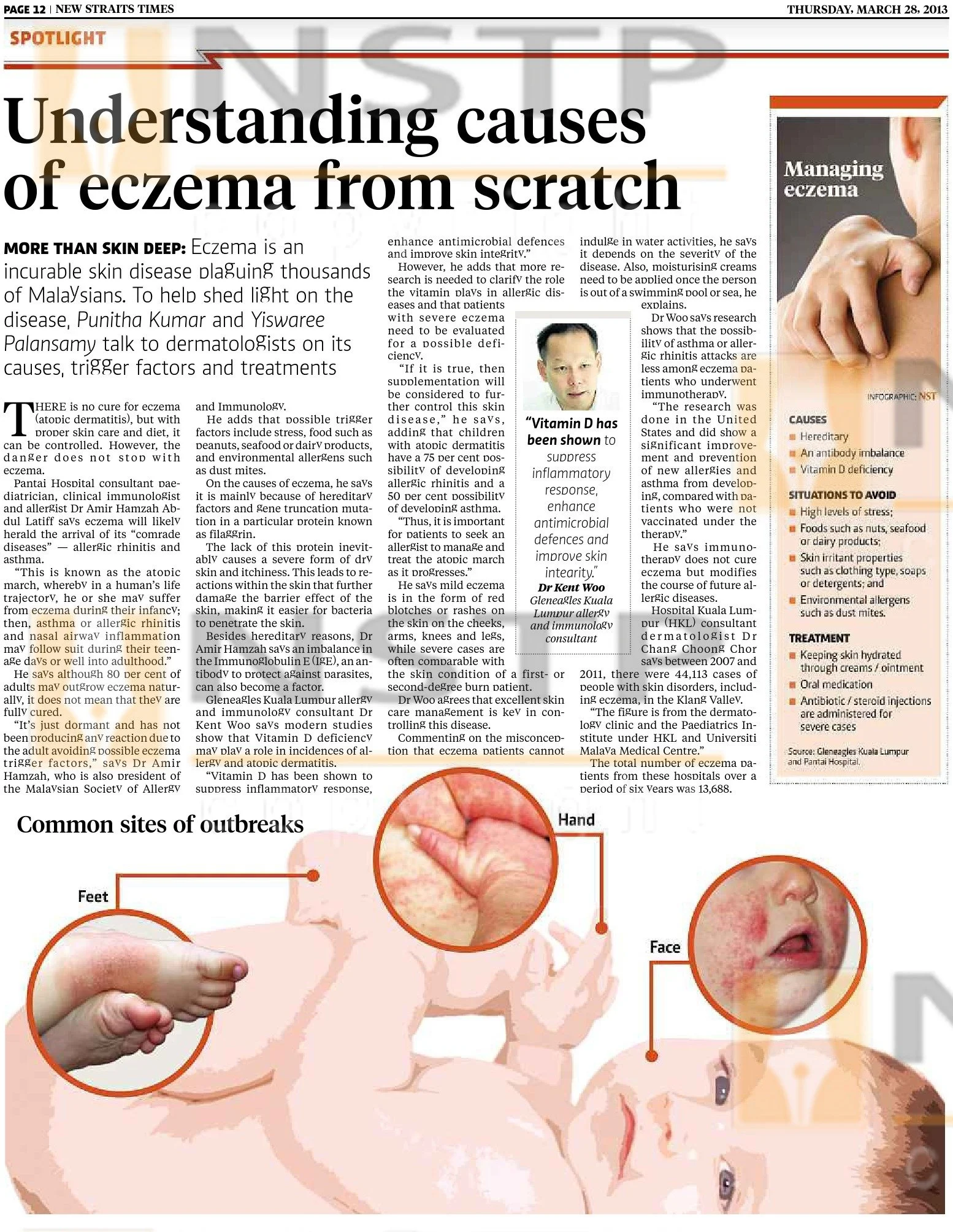 Ezcema.jpg