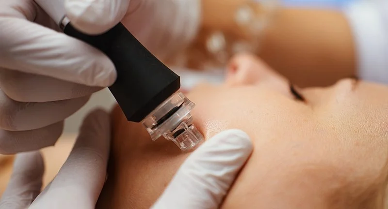 What Is A HydroDermabrasion Facial & What To Expect — ME SPA
