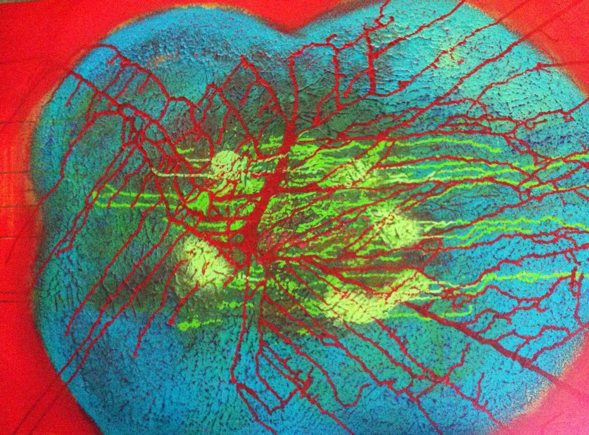 Bloodshot (2013) Acrylic