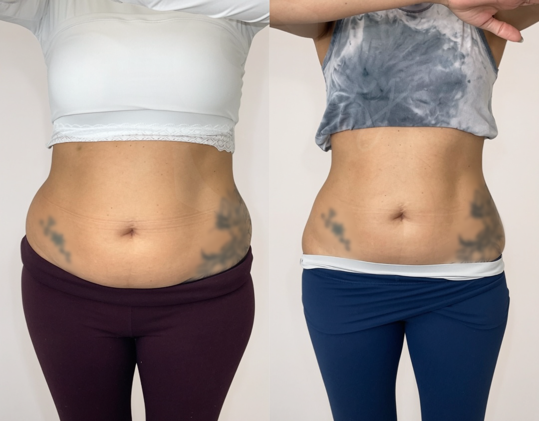 ba-02-midsection.png