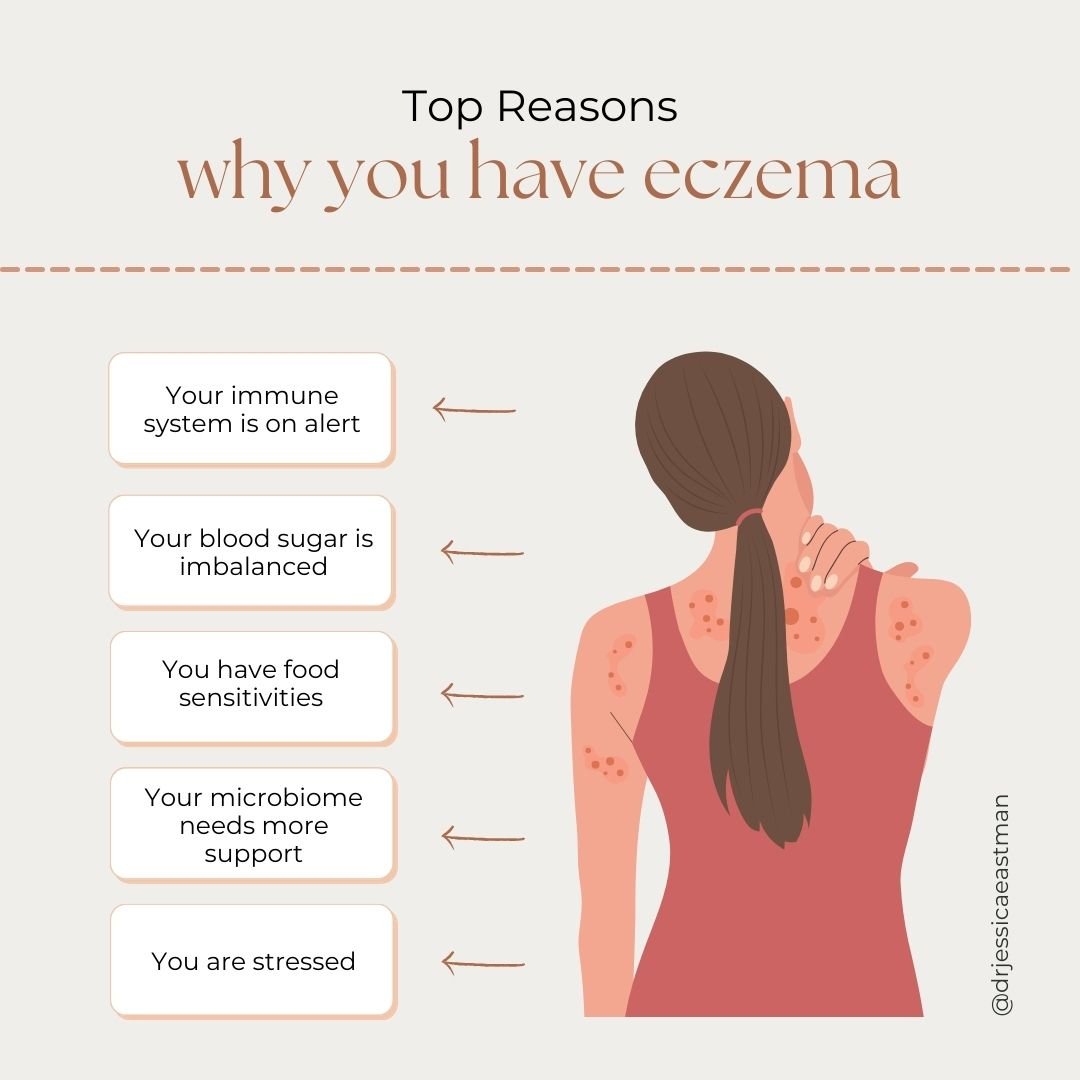Eczema can be a frustrating condition, with dry, itchy patches disrupting your comfort. While the exact cause remains a mystery, researchers have identified several factors that can contribute to flare-ups. Here's a gentle look at some of the top rea