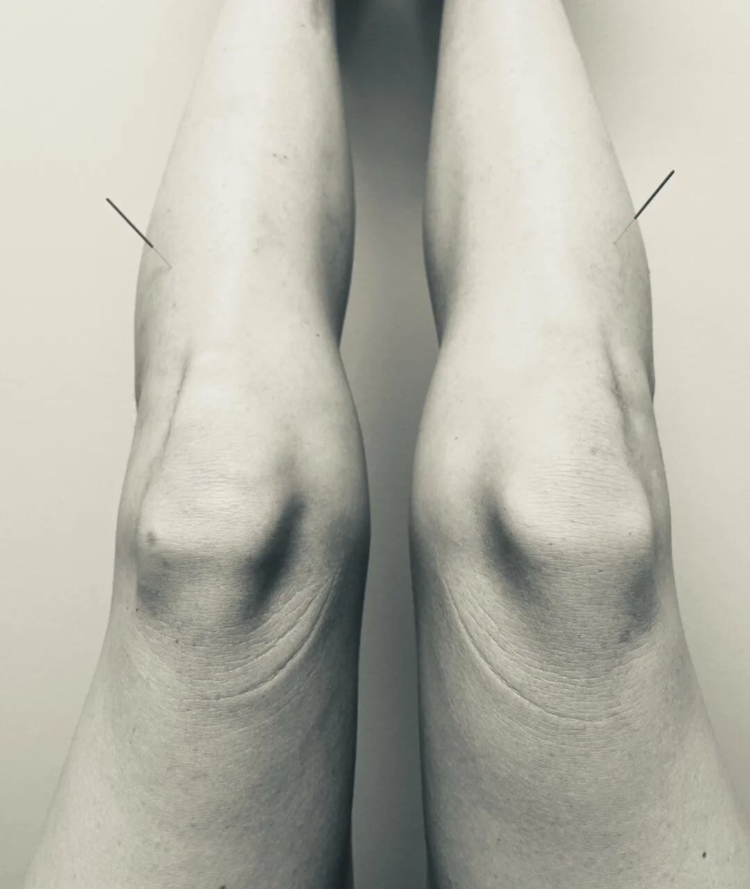 Pointe Acupuncture