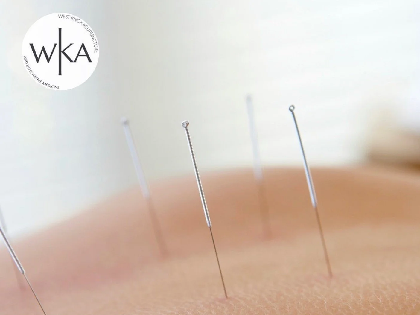 One question we hear all the time is:  “How does acupuncture actually work?”