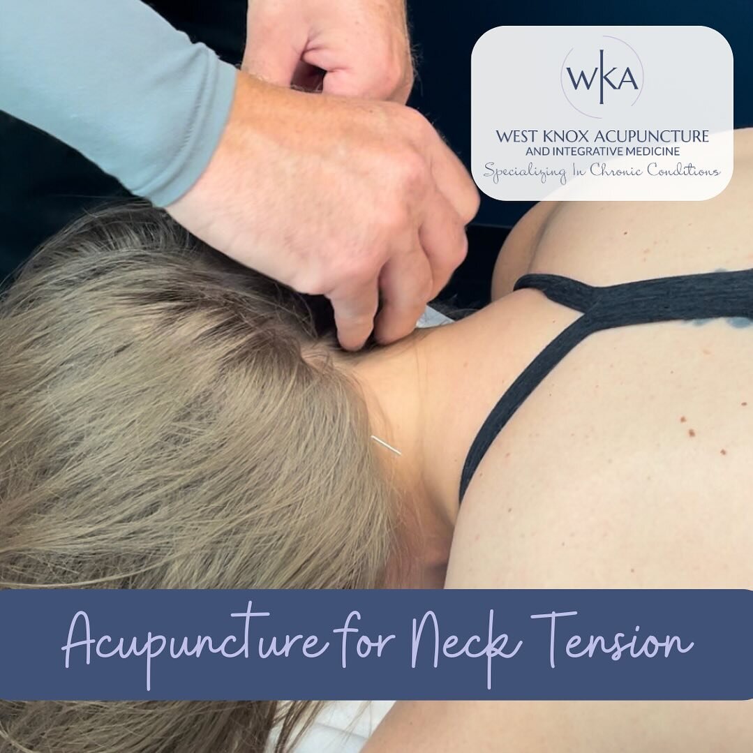 Neck pain is one of the most common conditions we see in the clinic. There are many reasons for neck pain ranging from muscle straining due to poor posture to more degenerative conditions like arthritis. No matter the underlying reason, ACUPUNCTURE h