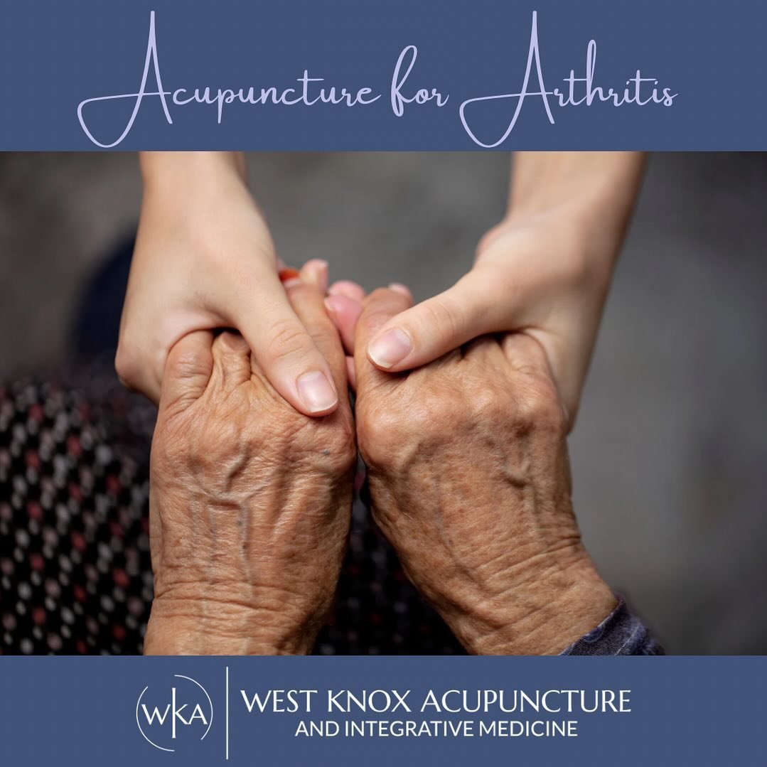 There are over 100 types of different arthritis pains. Depending on the type, it can be extremely painful and debilitating.  Arthritis is the inflammation of one or more joints. Most people experience common symptoms like joint pain, swelling, stiffn