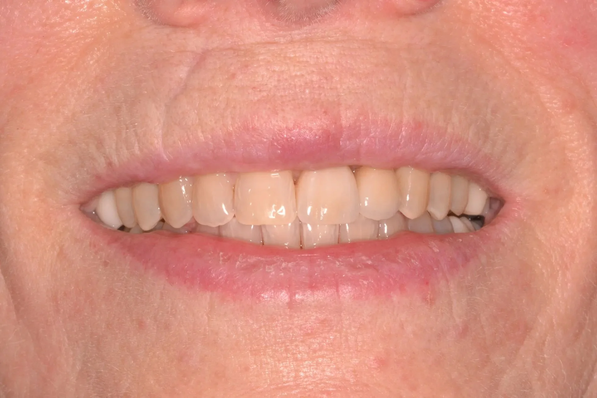 After treatment: the patient’s final smile
