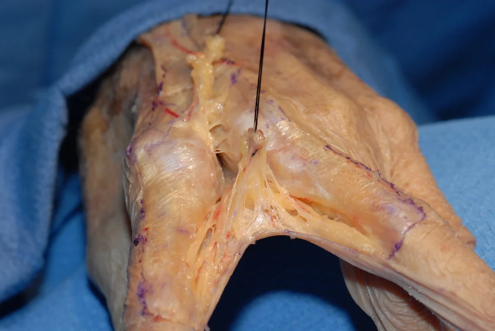 Hand Web Space Tethers — The Cinderella Layer and Fascia Tethers