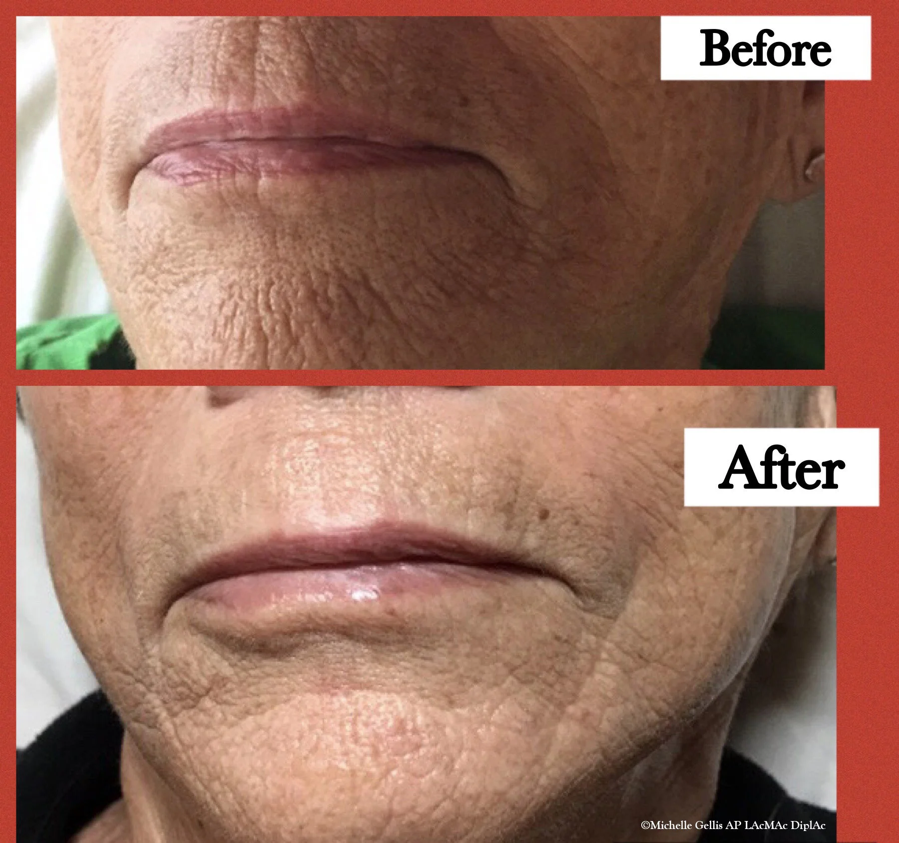 before after 8.JPG
