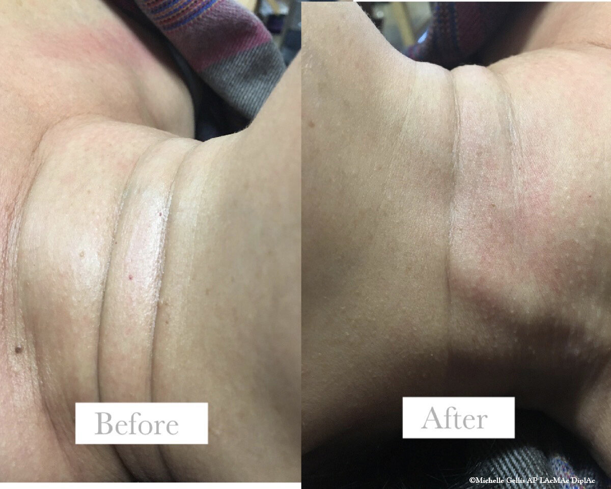before after 3.JPG