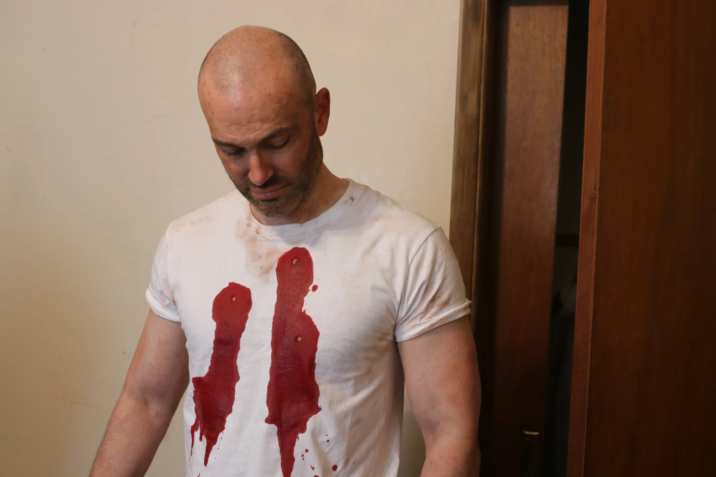 Evan gunshot wounds.jpeg