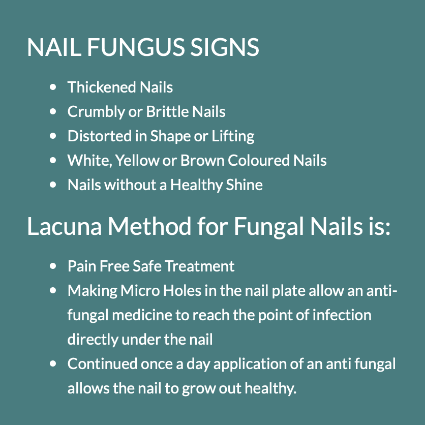 Fungal Nail Treatment Birmingham (The Lacuna Method) — Walsh Podiatry