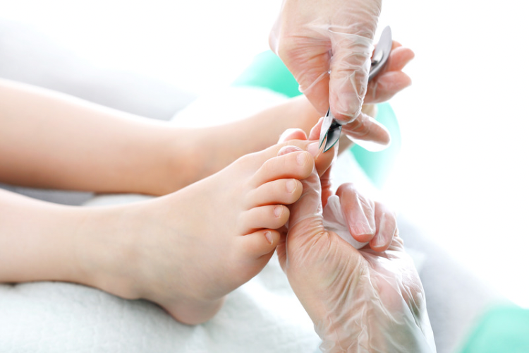 Fungal Nail Treatment Birmingham (The Lacuna Method) — Walsh Podiatry