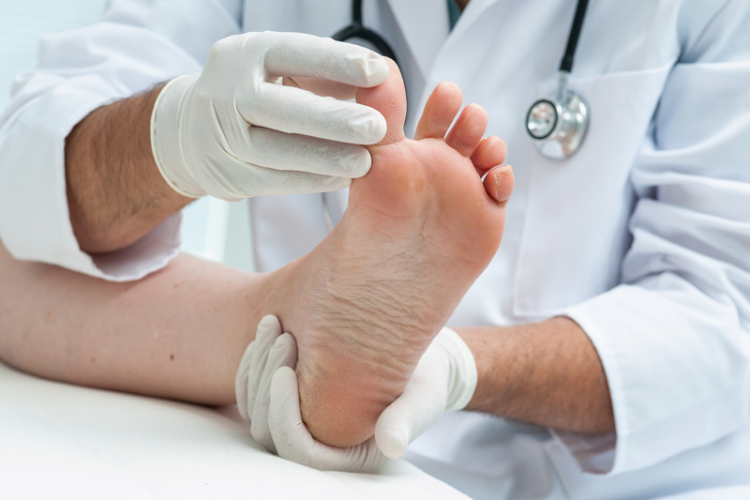 Fungal Nail Treatment Birmingham (The Lacuna Method) — Walsh Podiatry