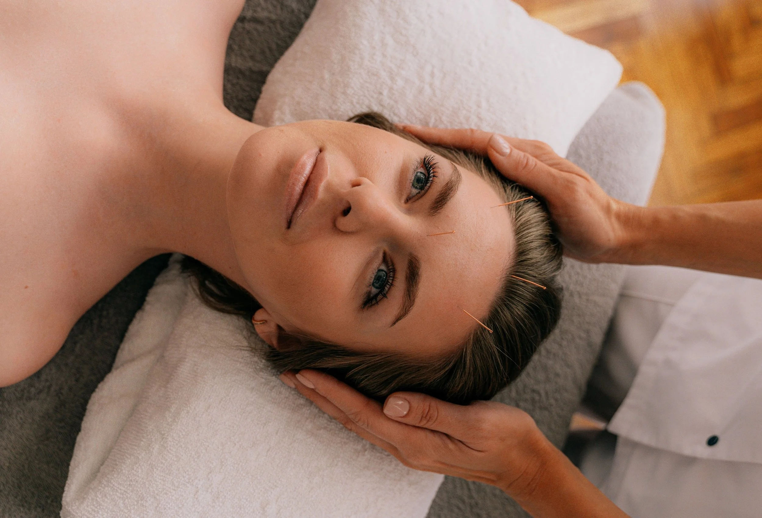 Cosmetic Acupuncture