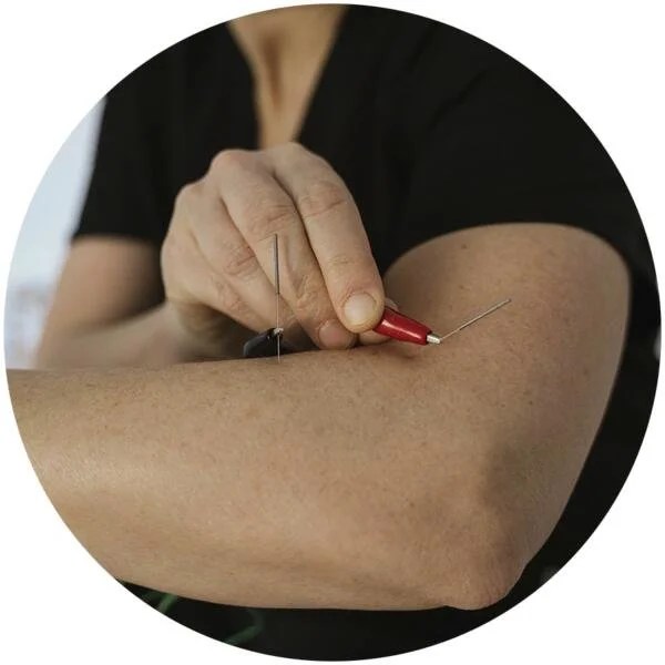 Electro-acupuncture treatment