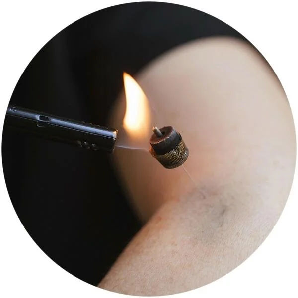 Moxibustion treatment