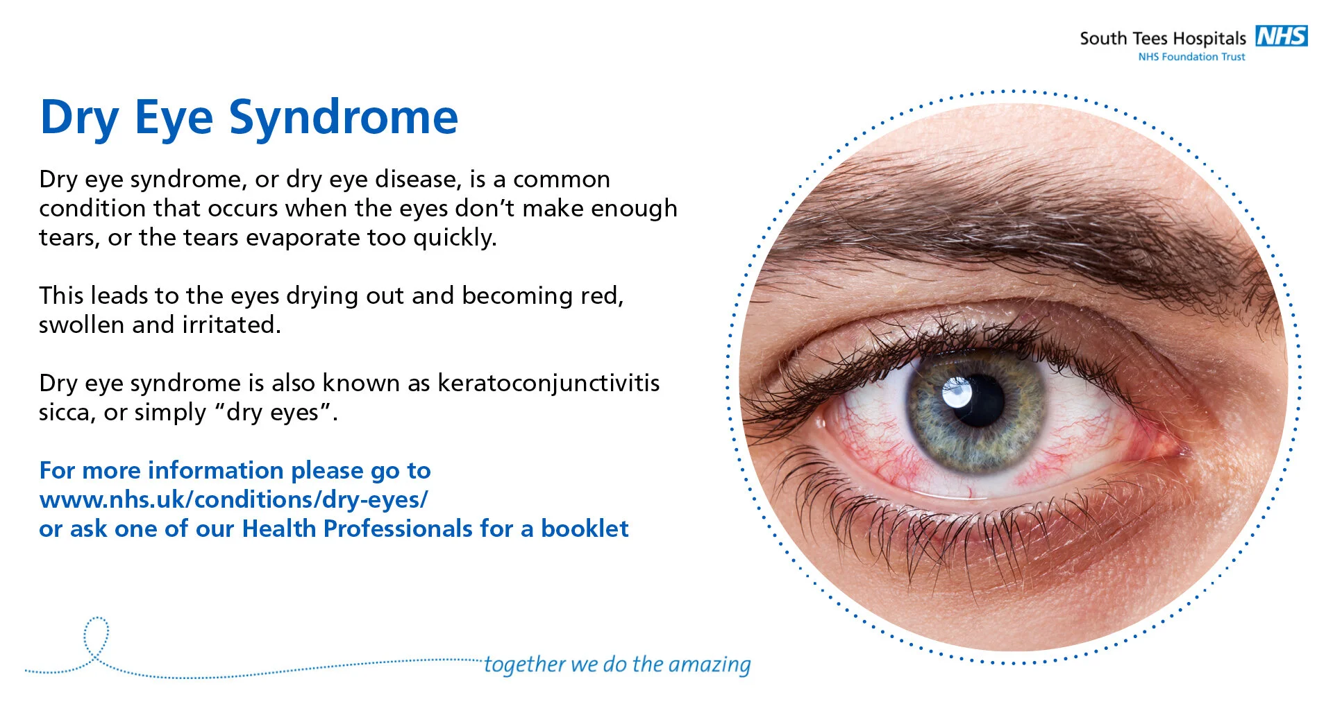 THMG-ST-SomeCommonEyeConditions-3-DryEyeSyndrome.jpg