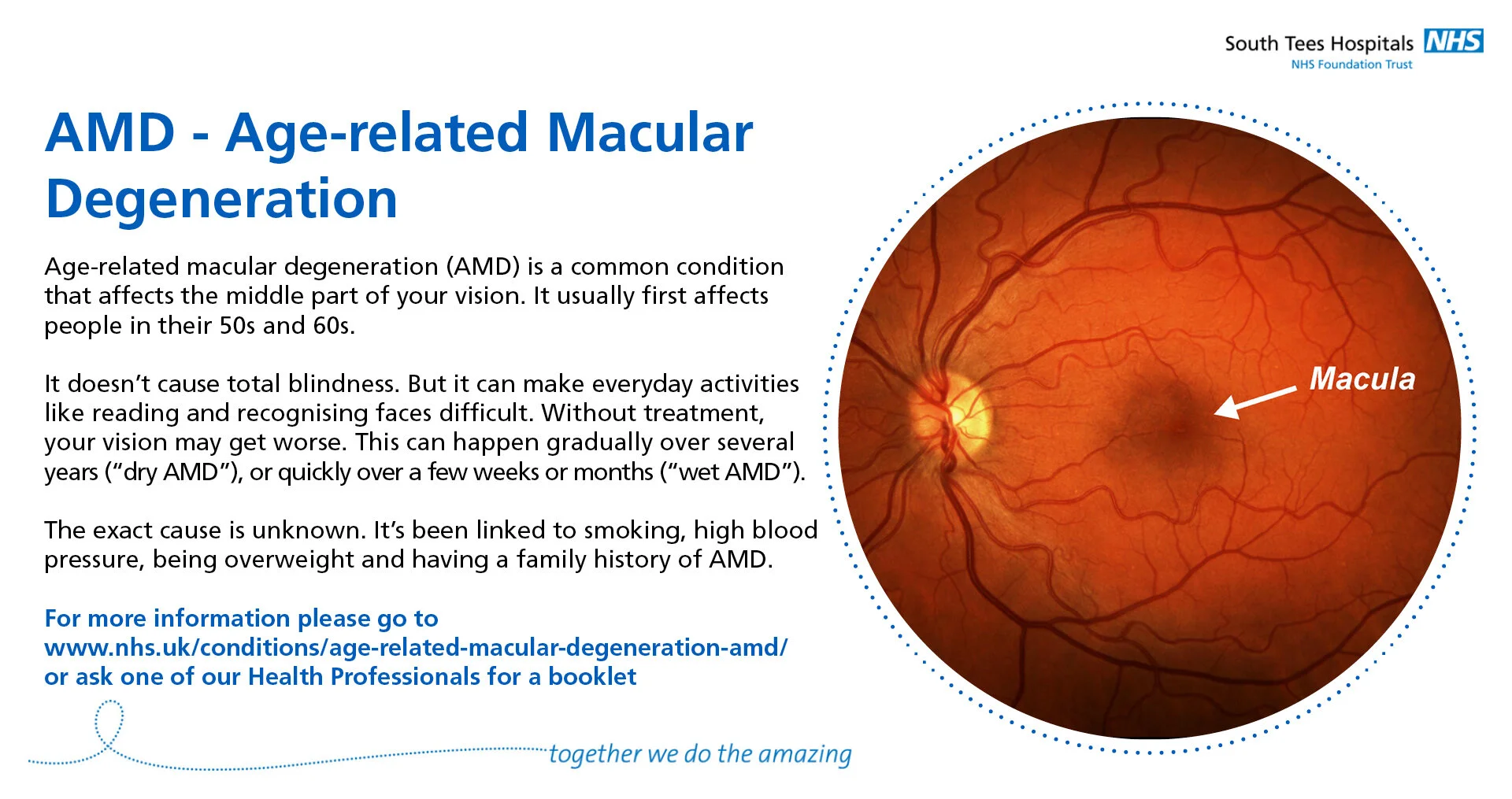 THMG-ST-SomeCommonEyeConditions-6-AMD.jpg