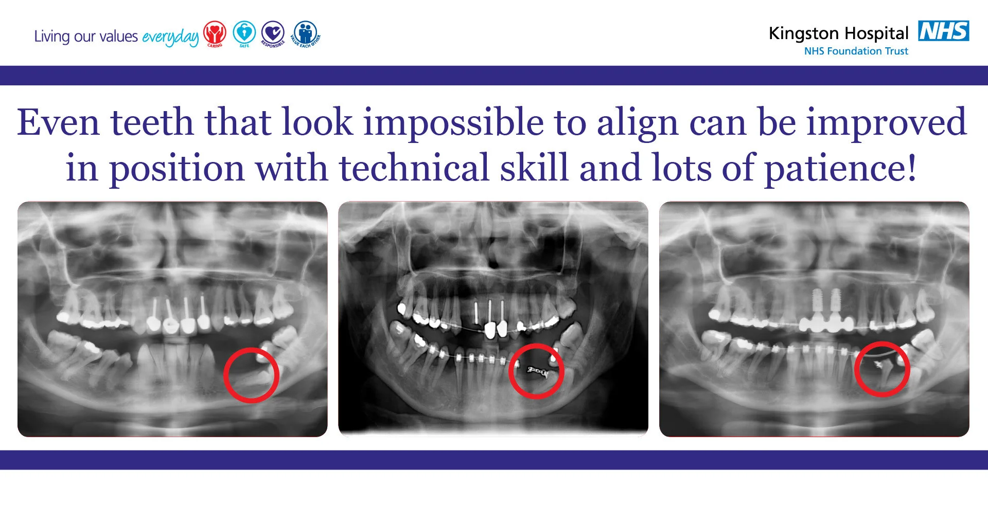 THMG-KH-EvenTeethThatLookImpossible.jpg