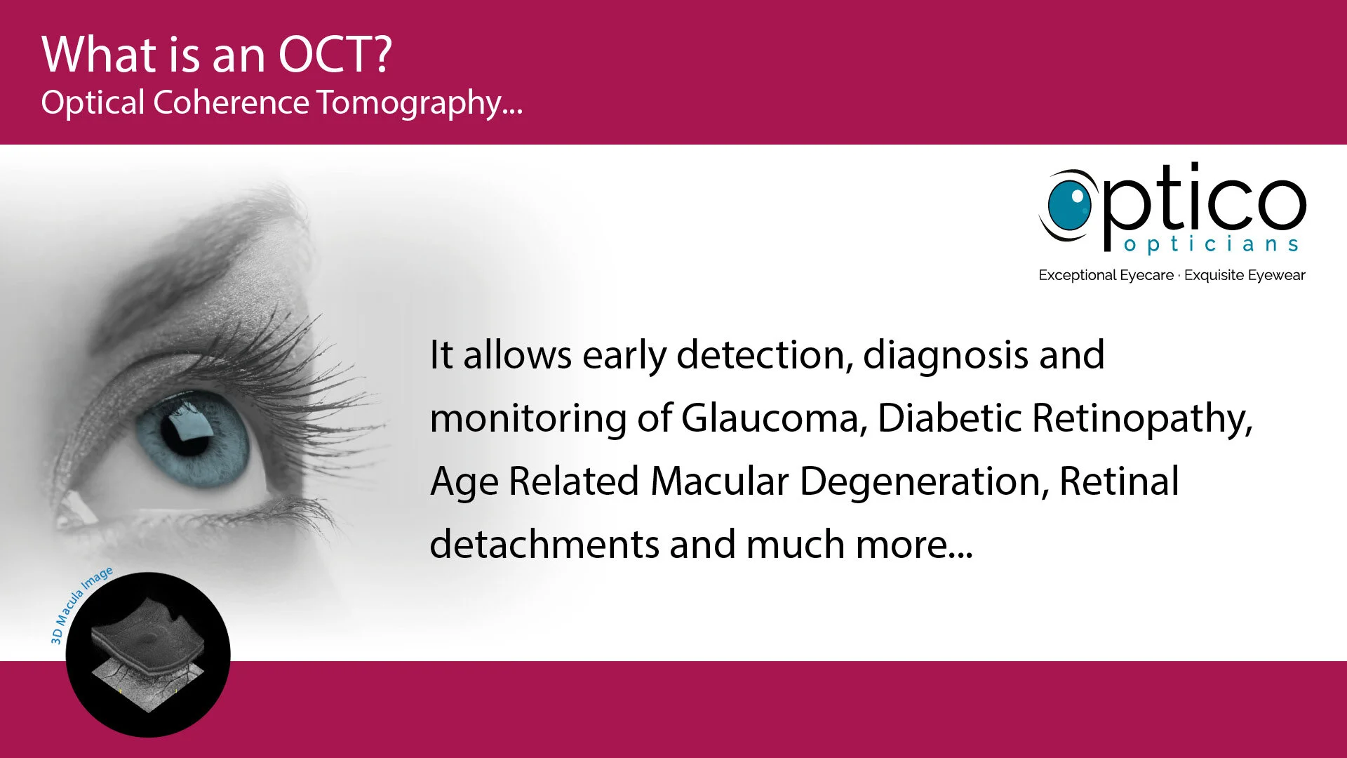 Optico-Opticians-Landscape-OCTScreening4.jpg