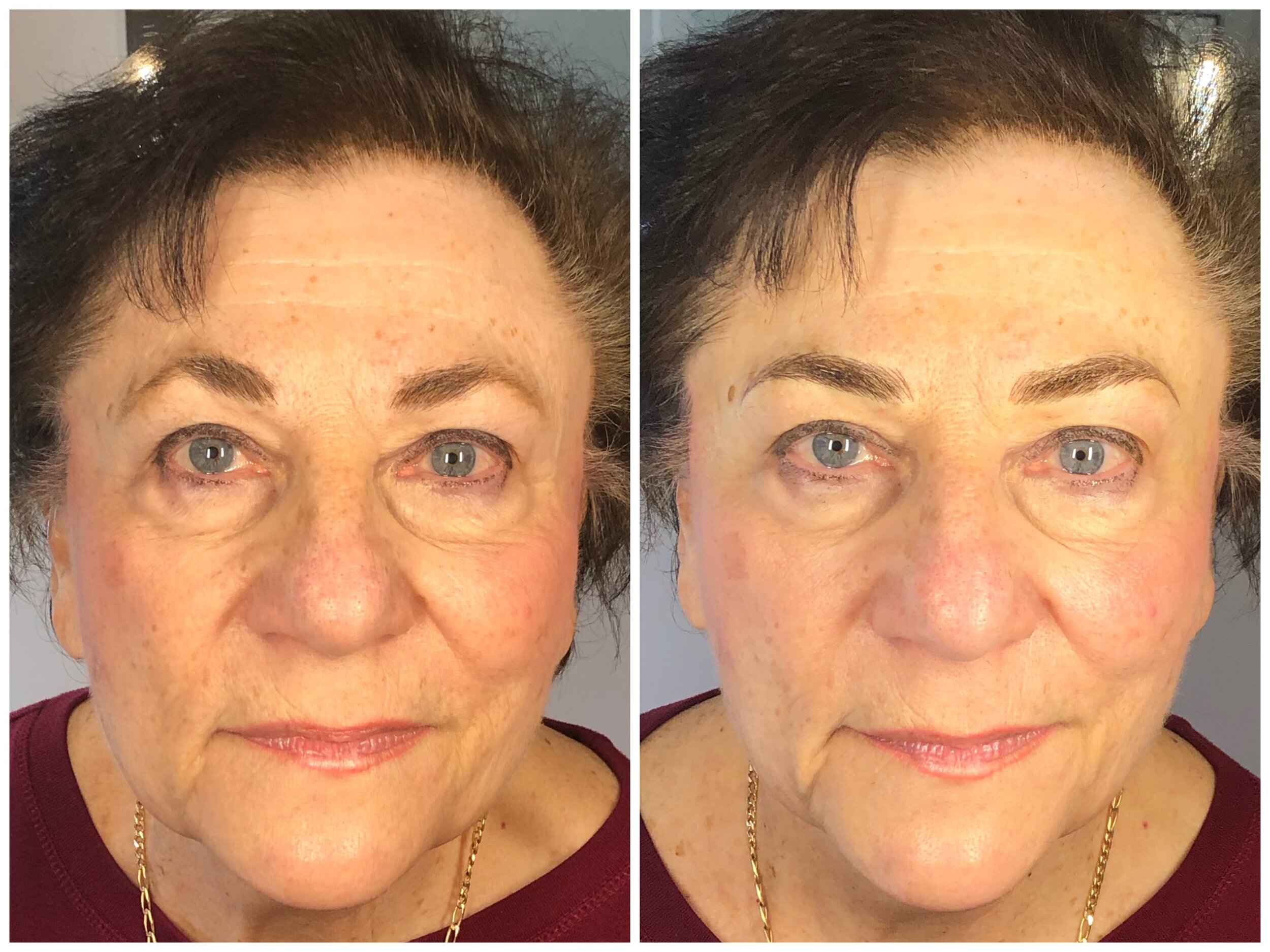 Side-by-side comparison of a woman before and after microblading treatment.