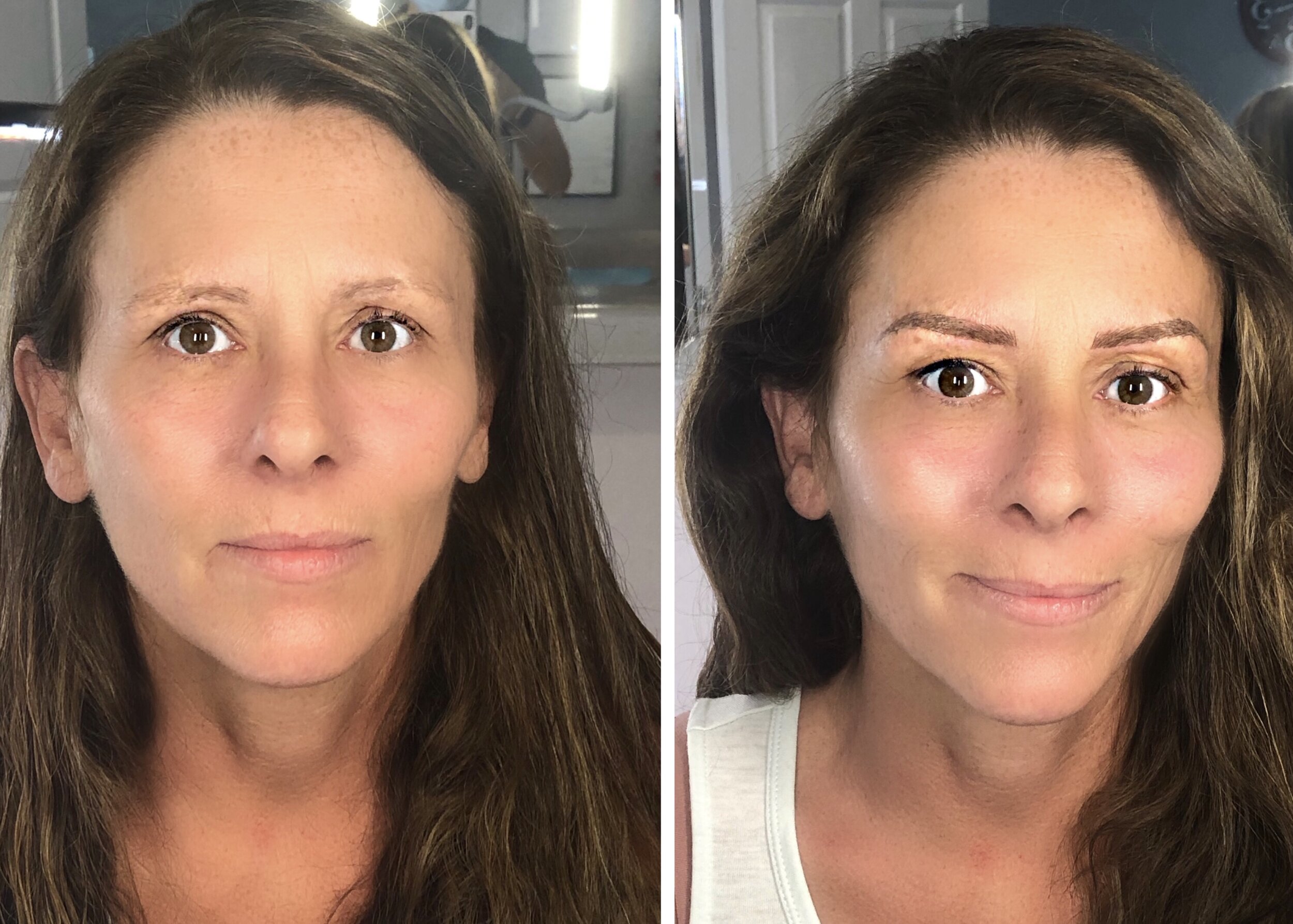 Side-by-side comparison of a woman before and after cosmetic treatment, showing improved skin tone, fuller eyebrows, and enhanced facial features.