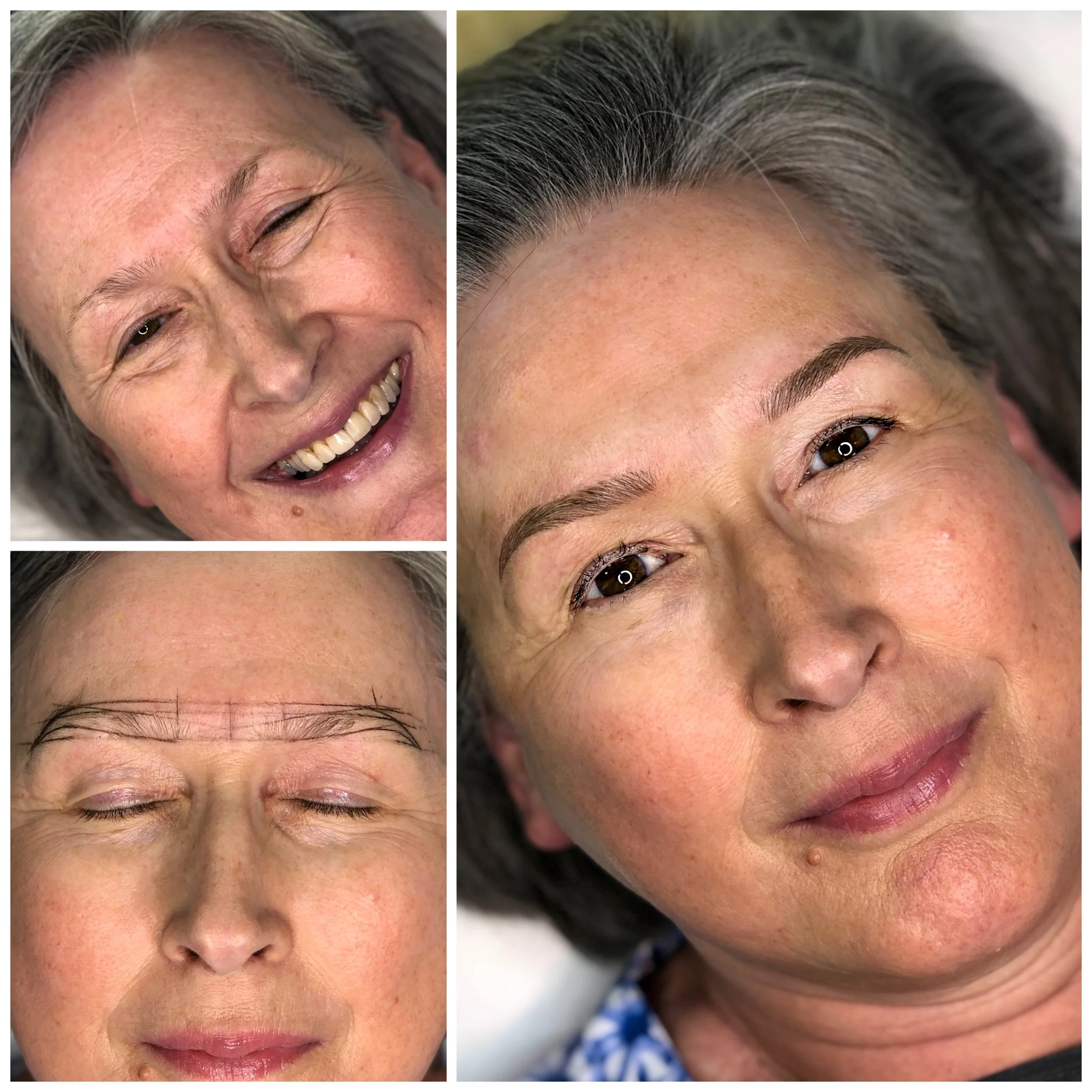 Close-up images of a woman before and after cosmetic eyebrow procedure, showing the transformation of her eyebrows.