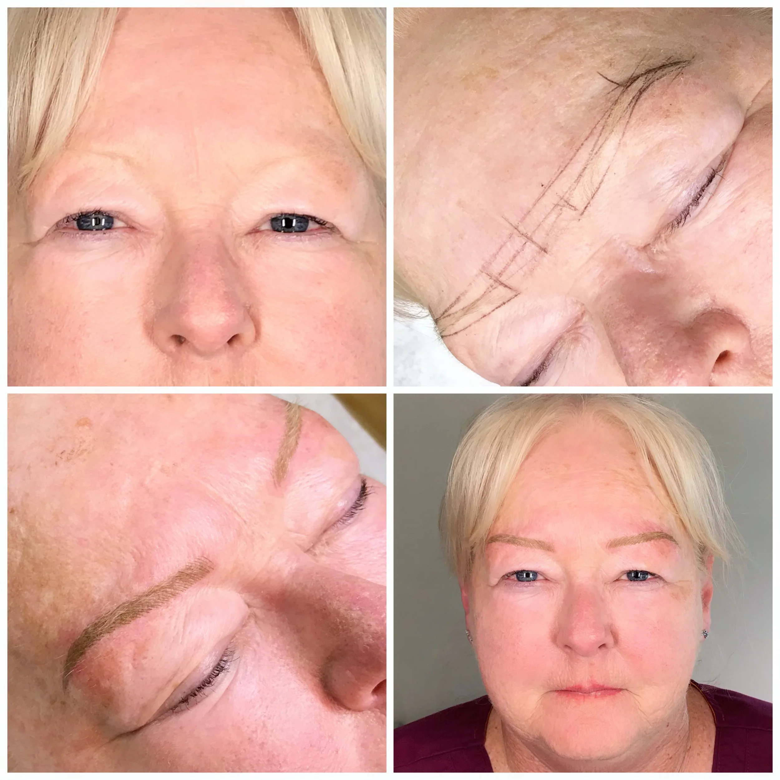 Before and after images of a woman's face showing enhanced eyebrows after cosmetic procedure, with drawings on her eyebrow to guide the procedure.