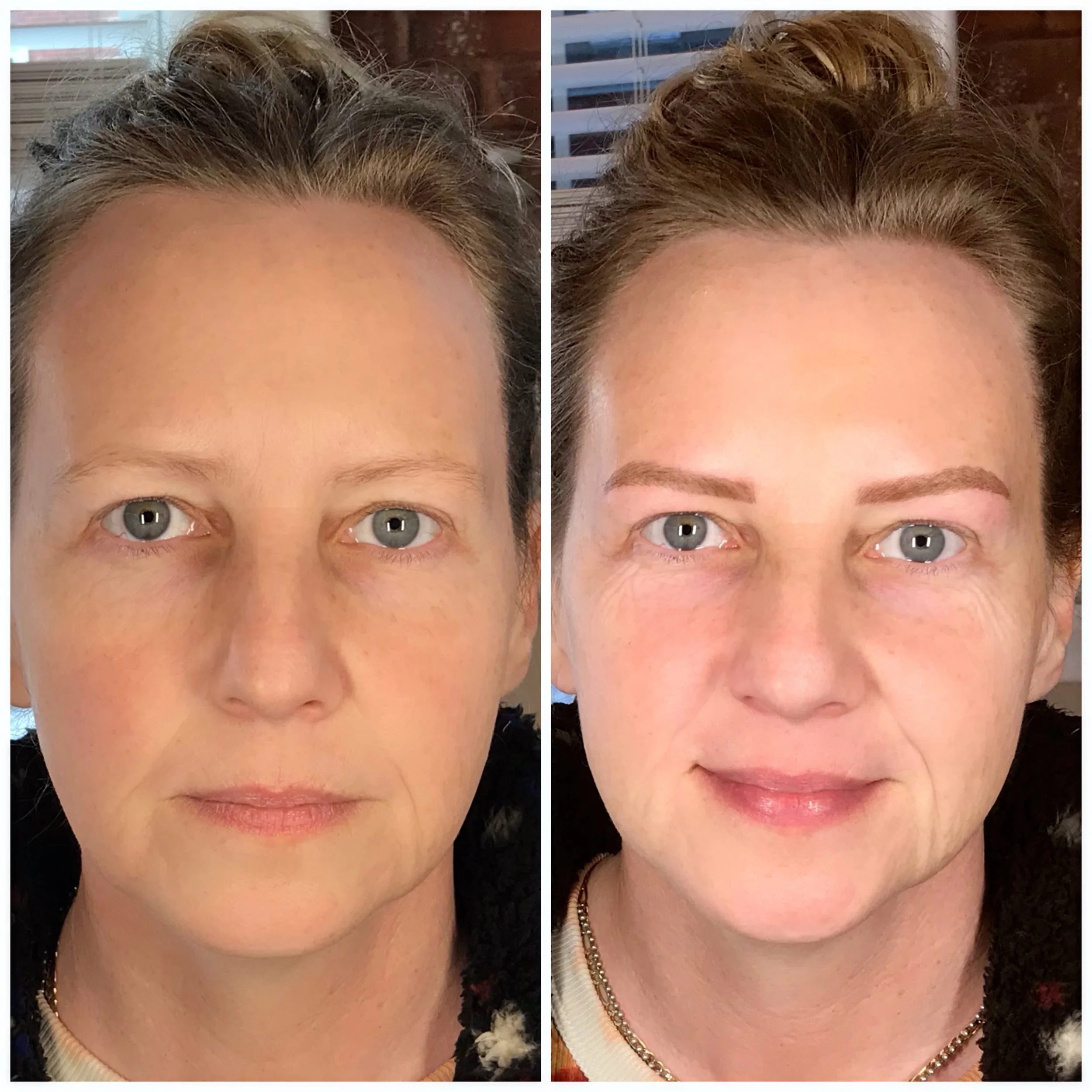 Comparison of a woman's face before and after cosmetic enhancement, showing improved eyebrows and skin tone.