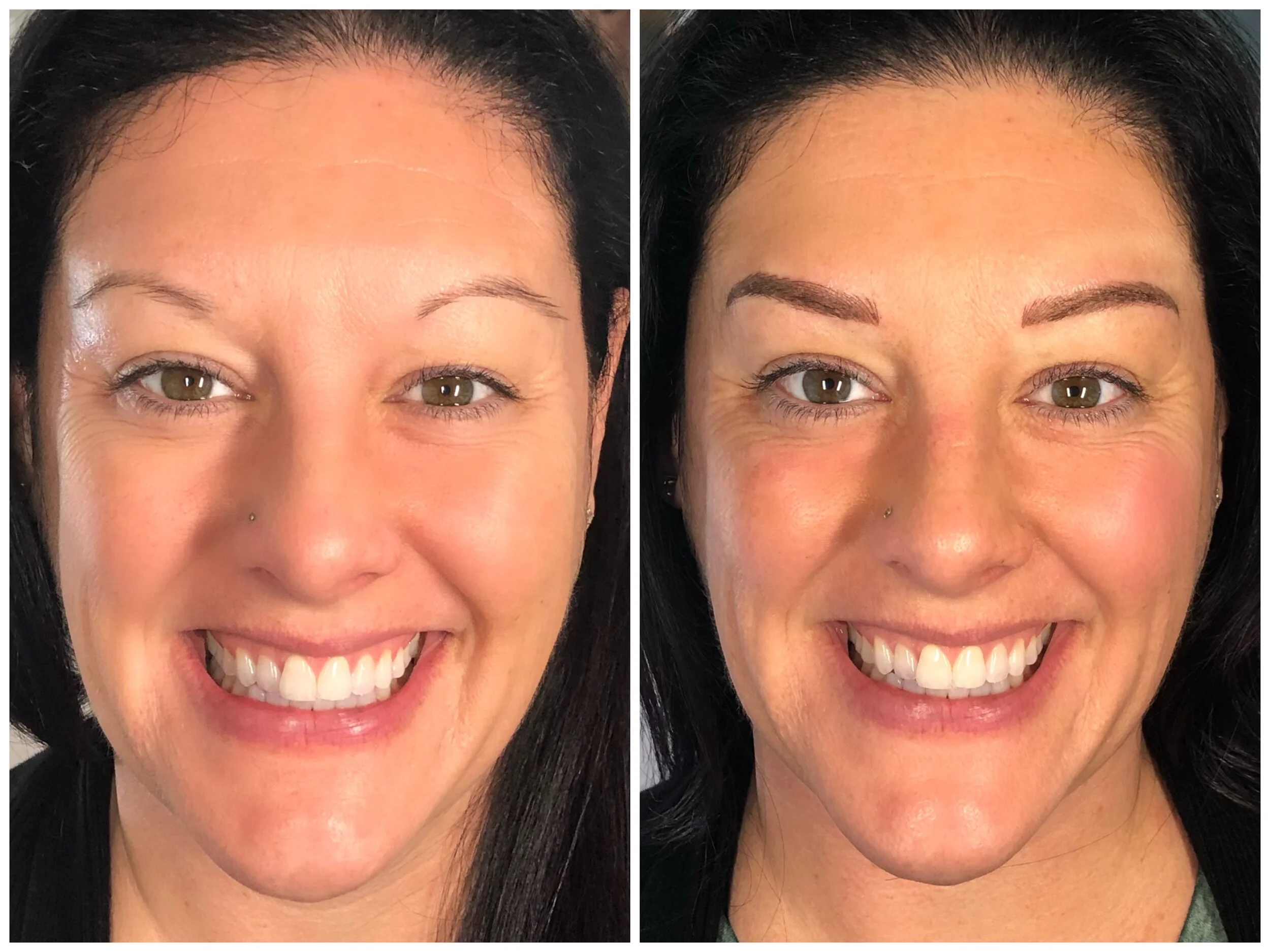 Before and after photos of a woman showing eyebrow enhancement; in the first photo, her eyebrows are thin and sparse, while in the second photo, her eyebrows are fuller and more shaped.