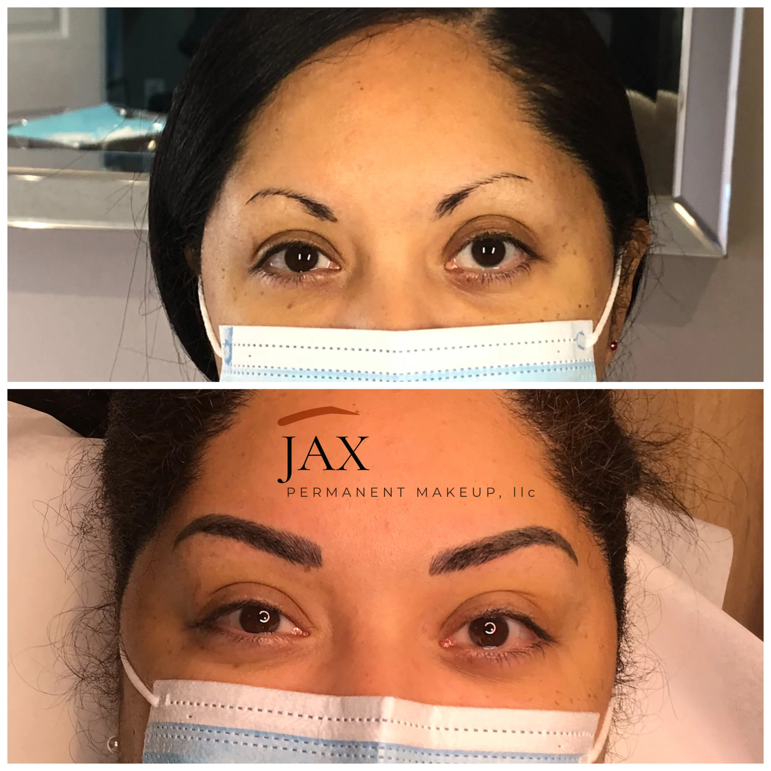 Comparison photo showing woman with natural eyebrows in top image and newly microbladed eyebrows in bottom image.