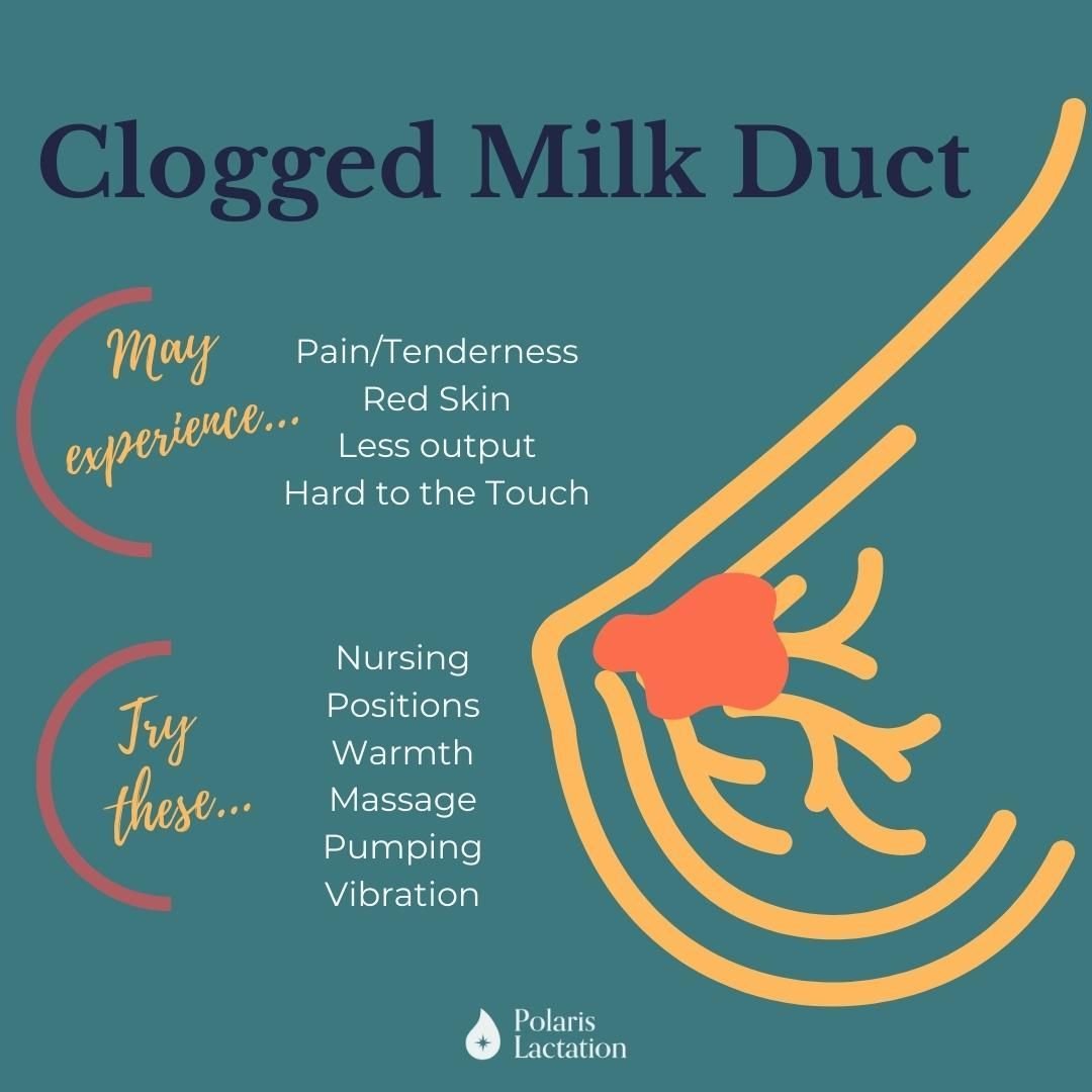 CLOGGED DUCTS

A clogged duct occurs when there is a temporary decrease in the ability to move milk. It can be cause by a missed feeding or pumping session, too tight of a bra, sleeping on that area of the breast, or even a clothing seam that is pres