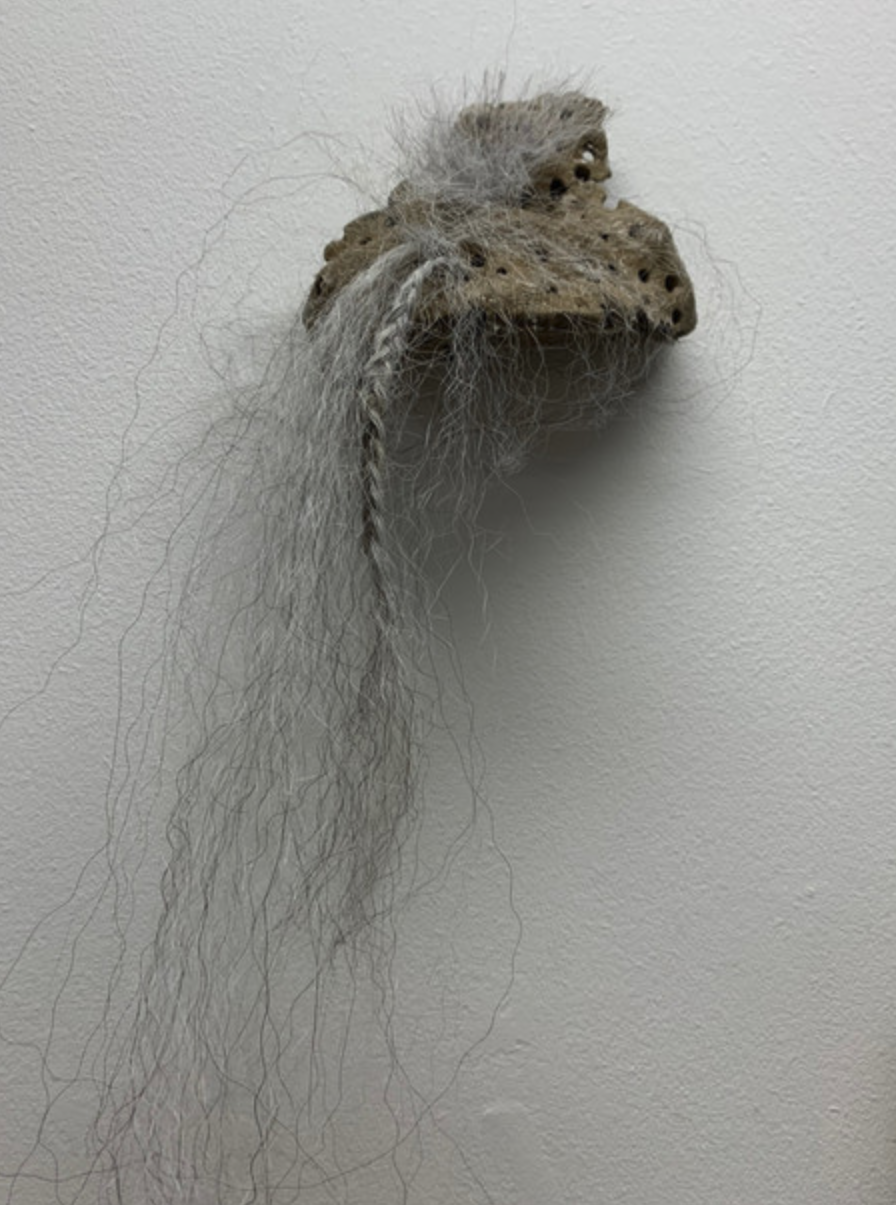 Hair Transplantation, 2020