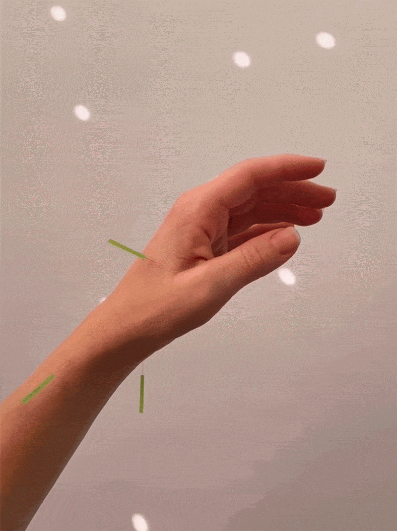 Hand floating against white background with green acupuncture needles in the wrist and hand, the image has subtle motion of light reflections floating across the hand and background