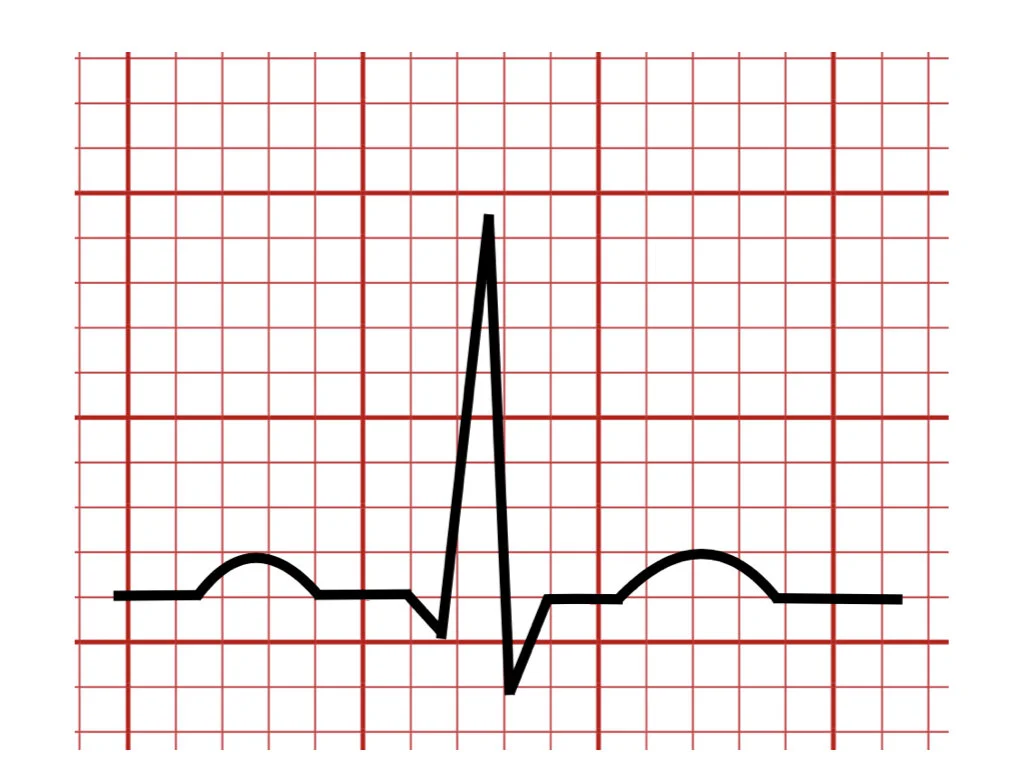 ECG Blog norwin marked JPEG.001.jpeg