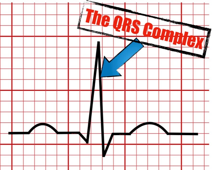 What Is A Normal Qrs Complex? : The normal QRS complex – ELLHU