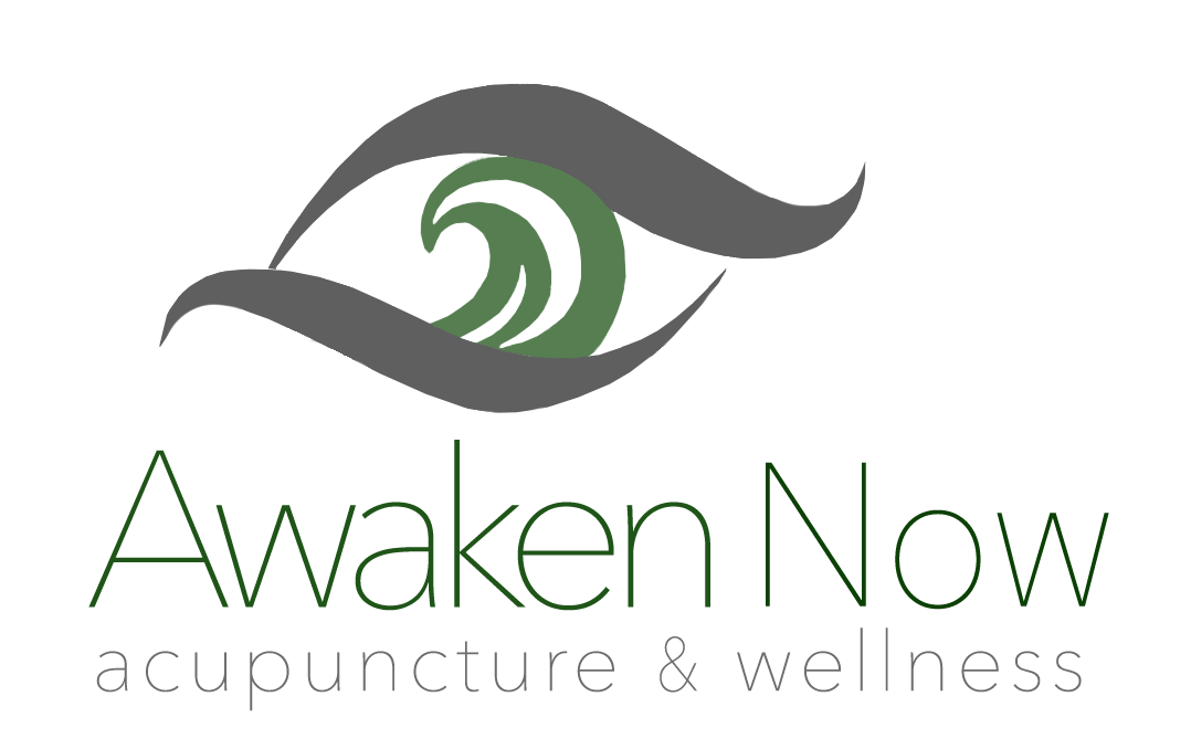 Electro-Acupuncture — Awaken Now Acupuncture & Wellness