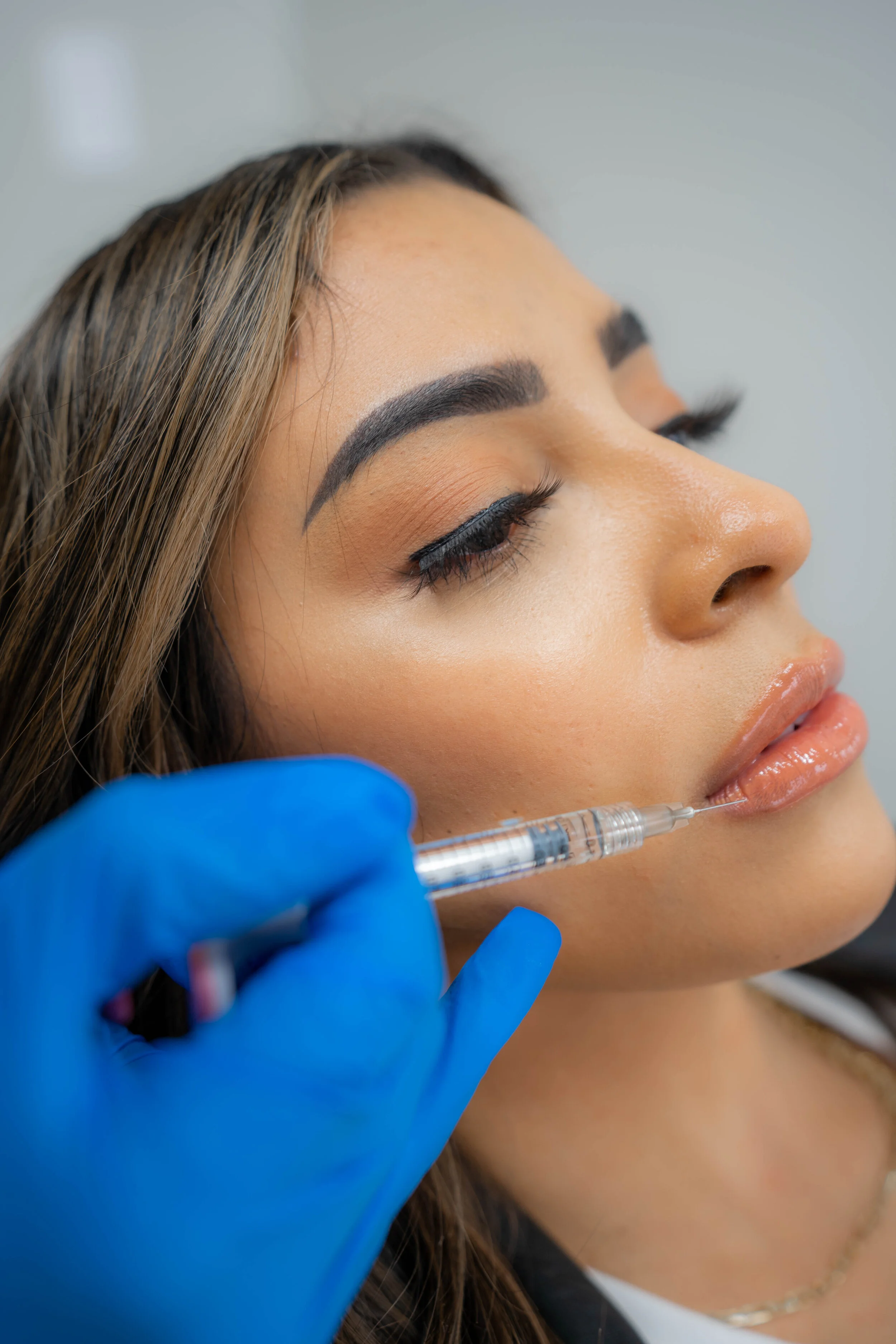 services-dermal-fillers.jpg