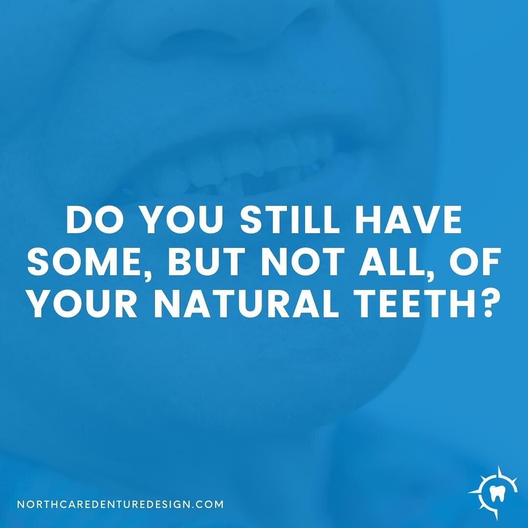 A partial denture replaces one or more missing natural teeth and is customized to a patient&rsquo;s individual needs. Removable partial dentures restore a person&rsquo;s natural appearance and greatly improve the ability to chew and speak clearly.

T
