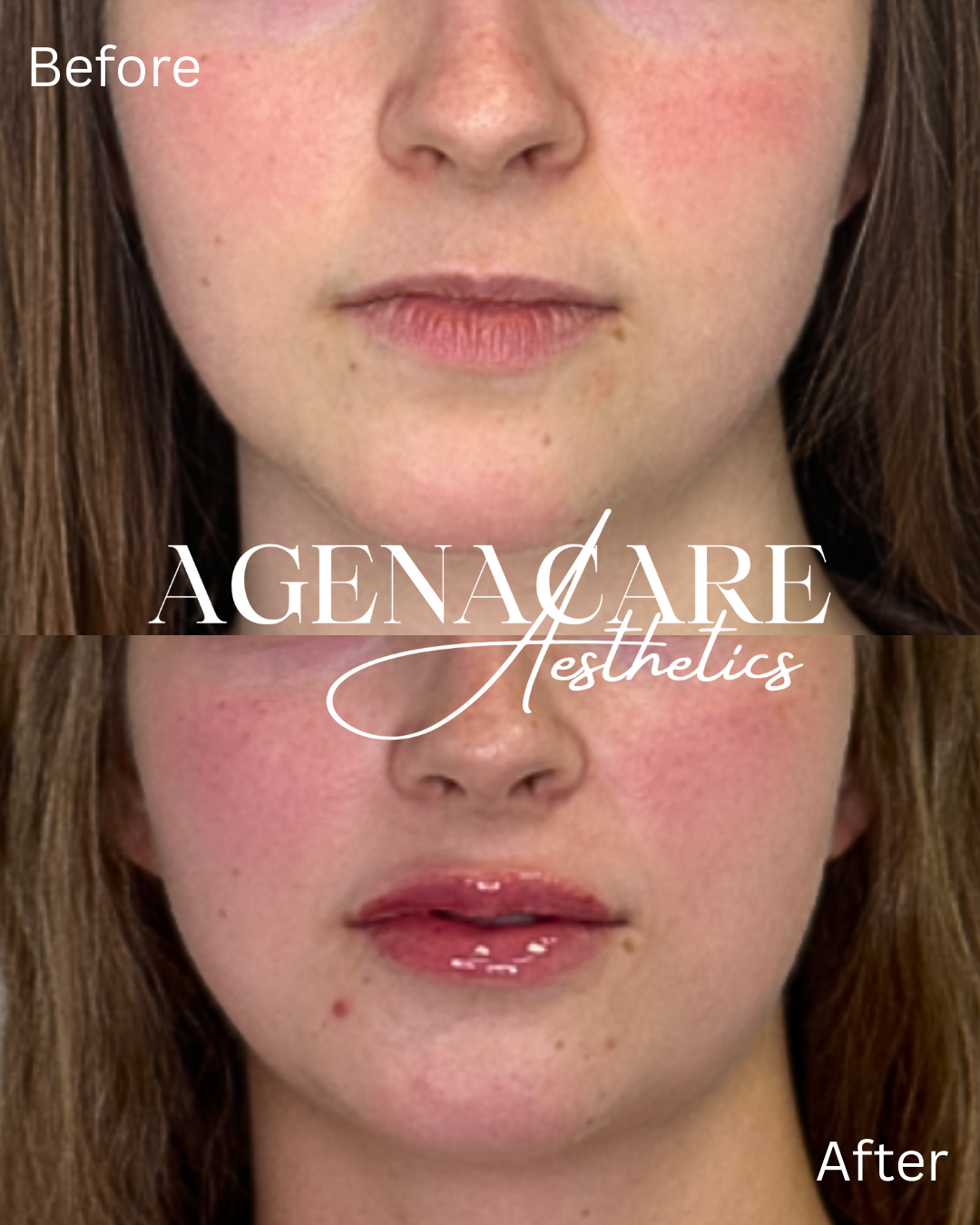 Before and After- lips.png
