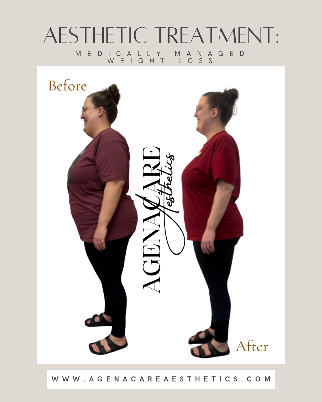 before and after weight loss.png