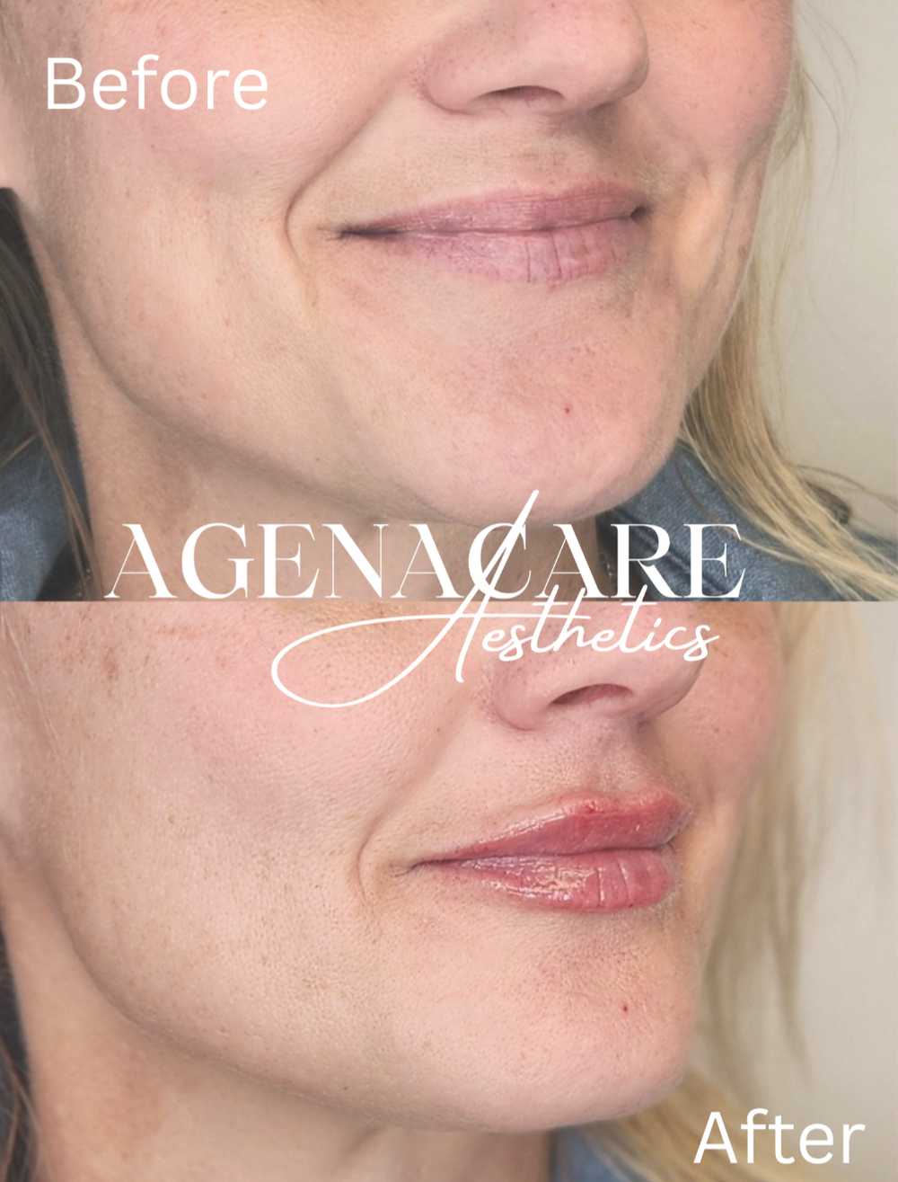 agenacare-aesthetics