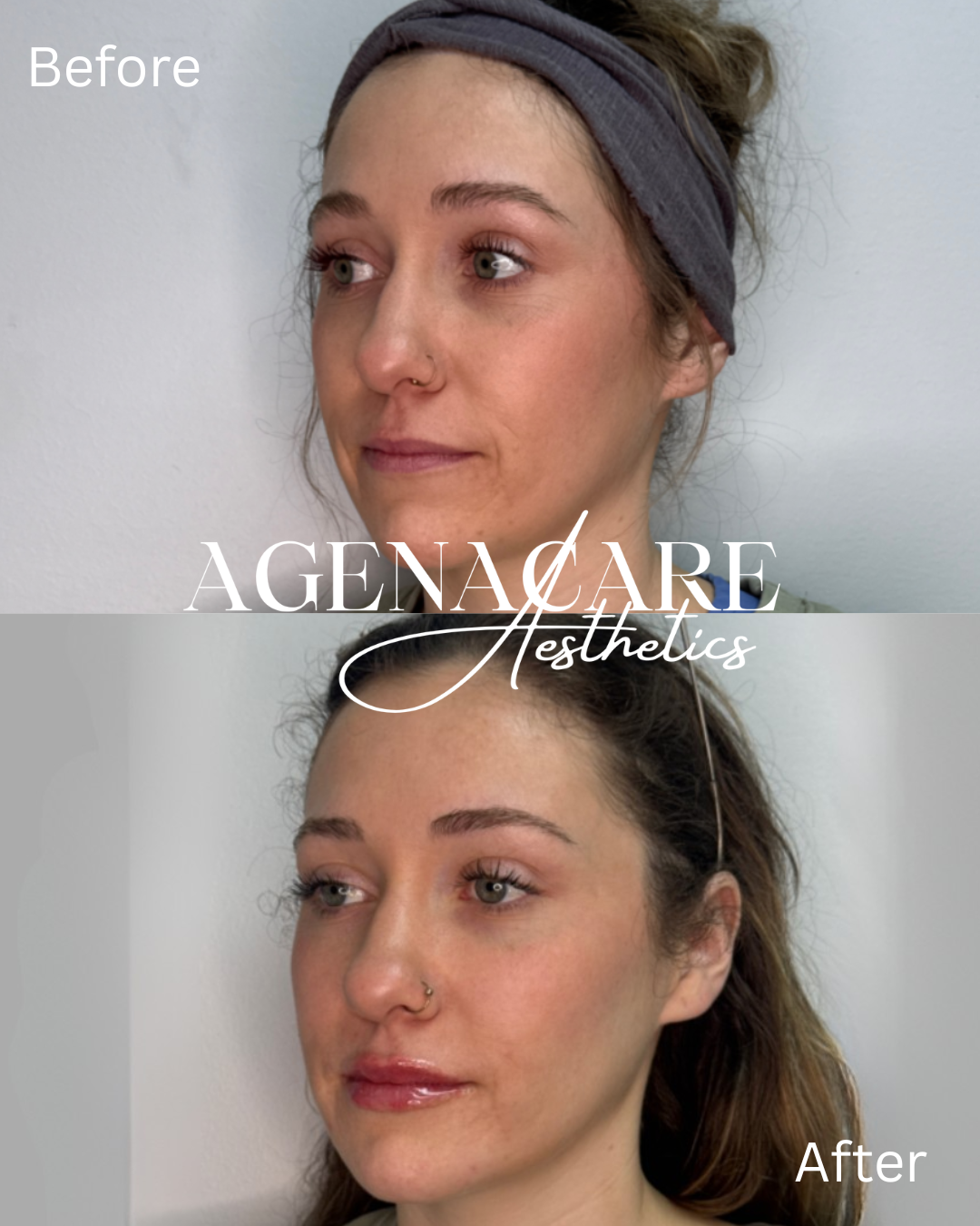 Before and after- skinvive and lips - Copy.png